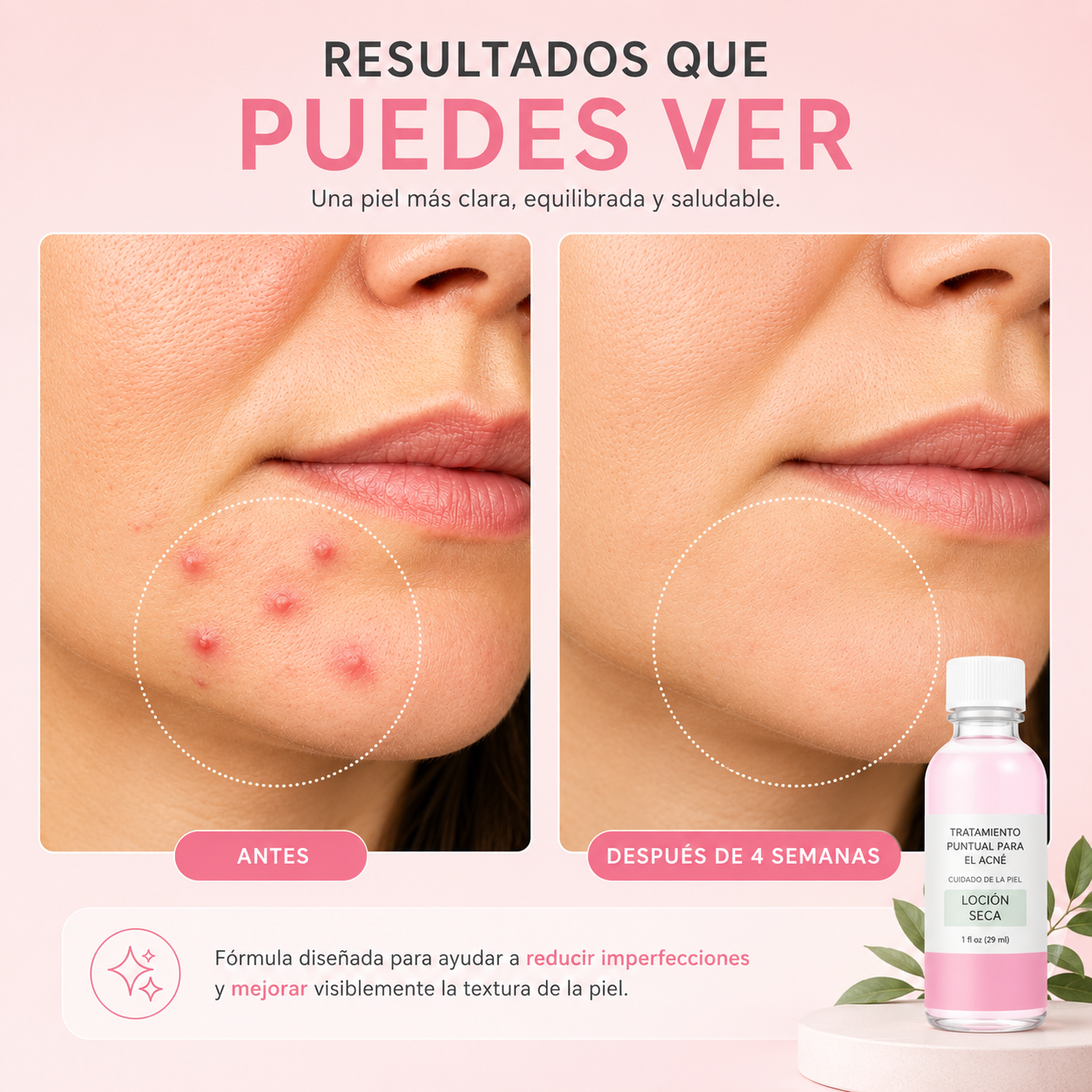Loción Secante Nocturna para Granitos e Imperfecciones – 29 ml