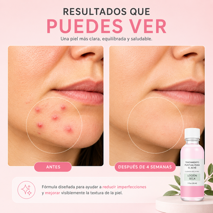 Loción Secante Nocturna para Granitos e Imperfecciones – 29 ml