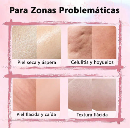 Crema Coreana Aumenta Glúteos y Anticelulitis  – 100ml