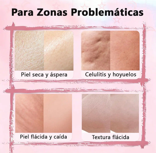 Crema Coreana Aumenta Glúteos y Anticelulitis  – 100ml