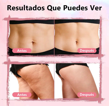 Crema Coreana Aumenta Glúteos y Anticelulitis  – 100ml